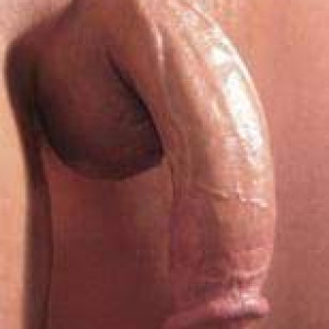 Asses to Moot